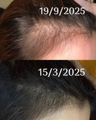 On Hair 生髮精華