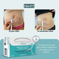 Oxyprolane Repair 修復(肌膚再生)營養補充膠囊 (60 粒)
