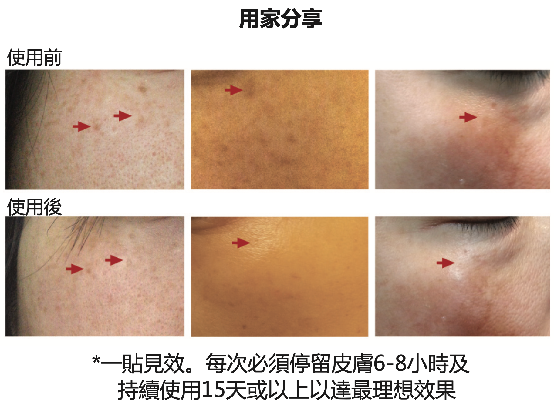 Methode Cholley 去斑追擊貼 CHOLLEY® CLEARING PATCHES (10 Patches)