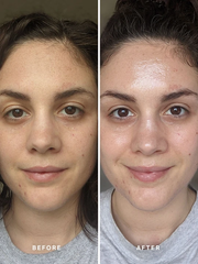 Alpha-H 黃金精華液 Liquid Gold