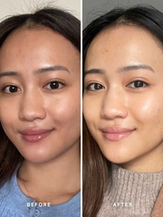 Alpha-H 黃金精華液 Liquid Gold