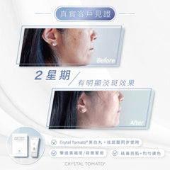 CRYSTAL TOMATO® 水晶蕃茄® 祛斑霜（升級配方）