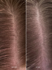 Alpha-H 去角質強健頭皮護理