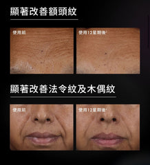 SkinCeuticals H.A 多重飽滿緊緻精華 H.A. Intensifier Multi-Glycan