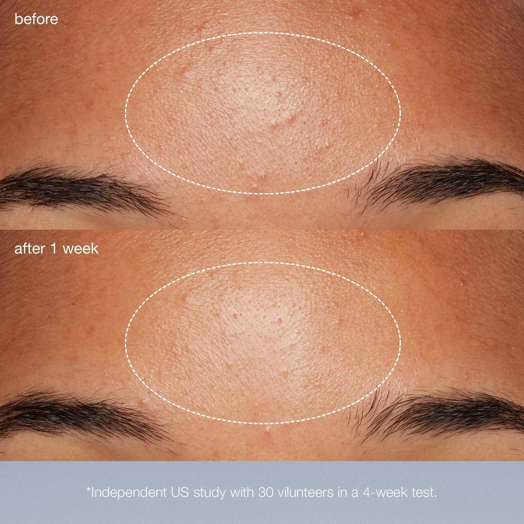 [香港行貨] dermalogica 微型美白酵素粉末 daily microfoliant exfoliator