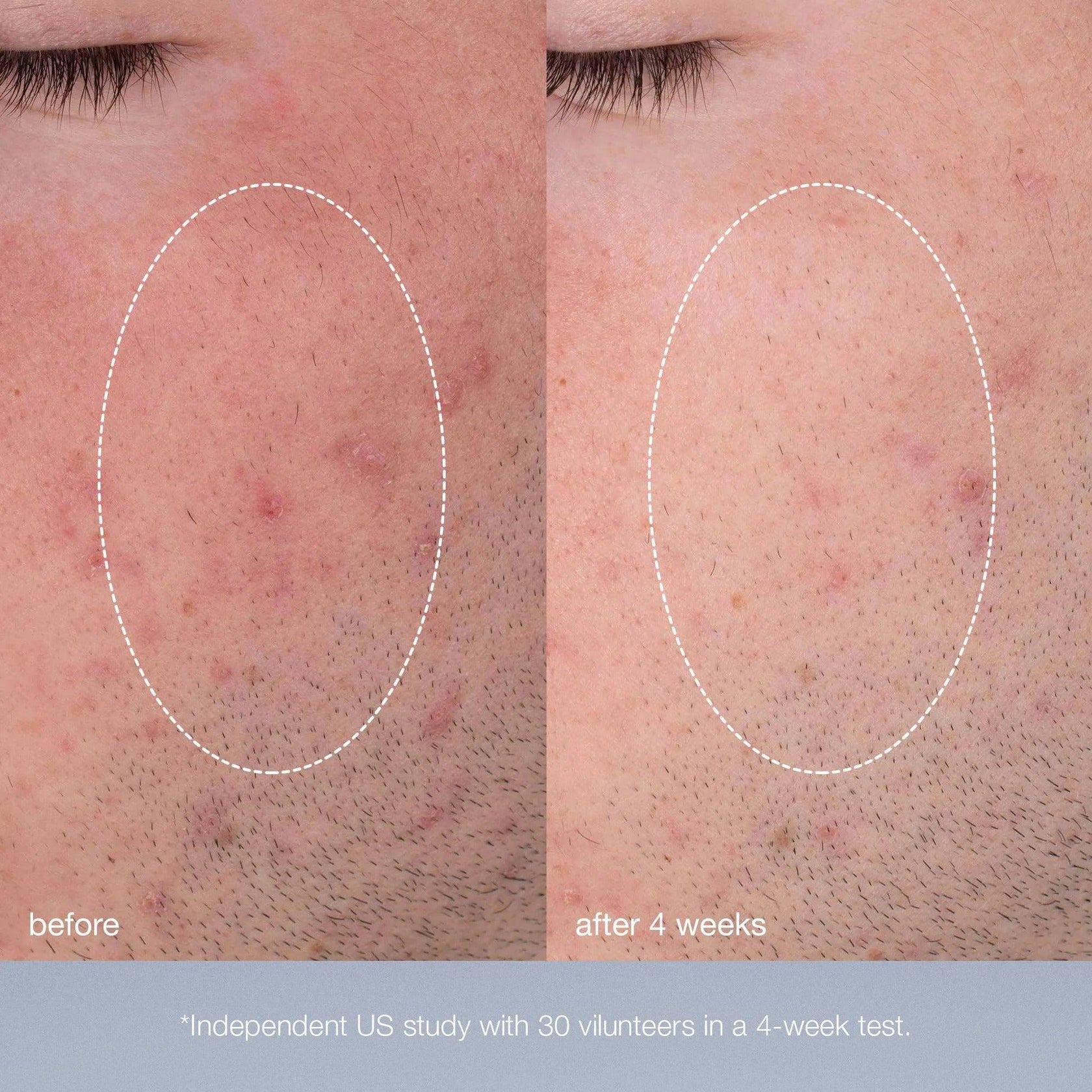 [香港行貨] dermalogica 微型美白酵素粉末 daily microfoliant exfoliator