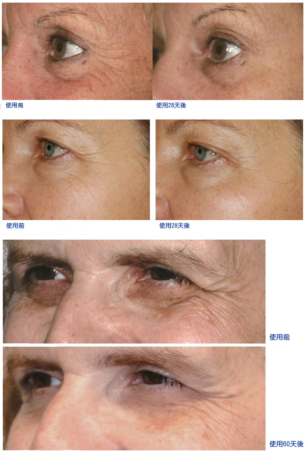 REJUVE MD 全效再生眼霜 Anti-aging Eye Serum